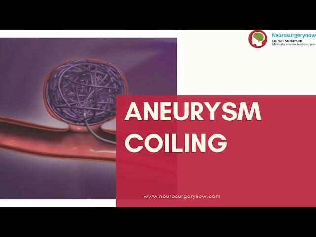 Aneurysm coiling  | Aneurysm Treatment  |   Neurosurgeon in Hyderabad