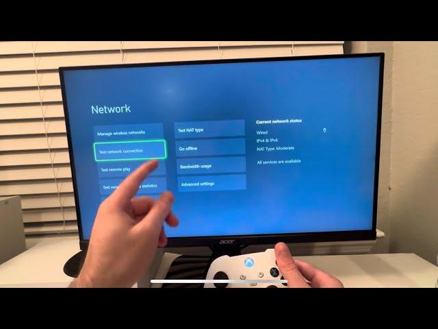 Xbox Series X/S: How to improve internet speeds on Xbox Series X/S (100% WORKS!) (2024)