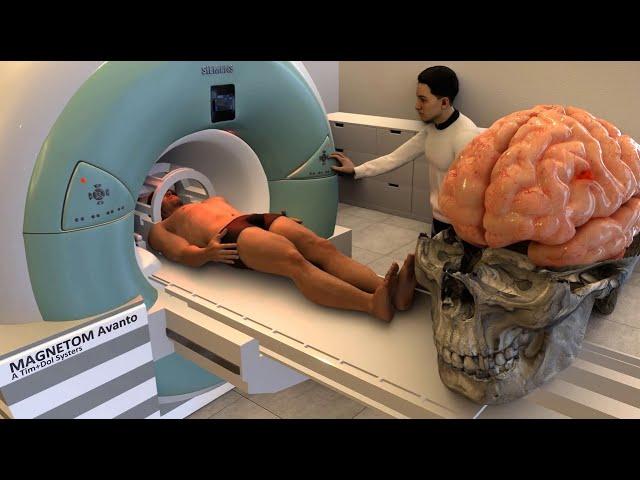 How does an MRI machine work?