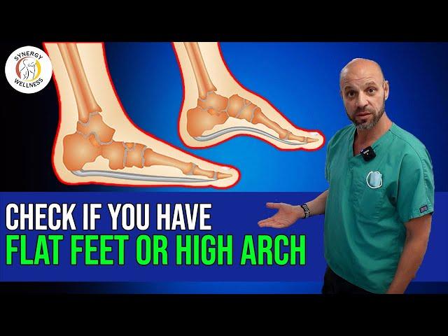 How To Check if You Have Flat Feet or High Arch