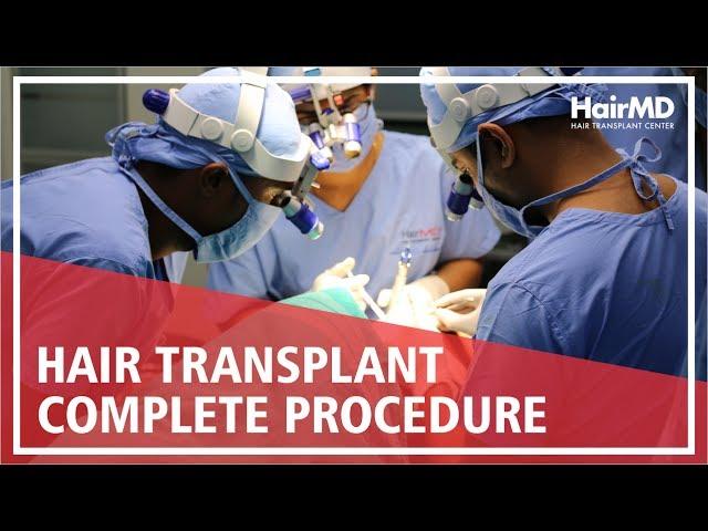 Hair Transplant - Complete procedure at HairMD Clinic Pune