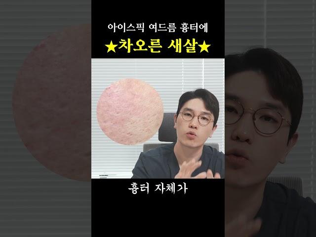#여드름흉터치료 #여드름흉터제거 #아이스픽흉터 #송곳흉터 #새살침한의원 #새살침 #새살침후기 #흉터읽어주는한의사 #shorts