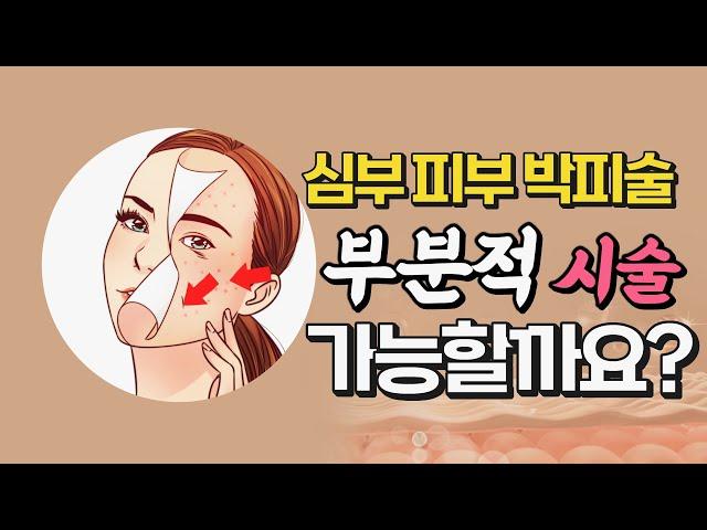 심부박피 입가주름 팔자주름 여드름흉터 부분적으로 치료 가능한가요? #심부박피#여드름흉터#주름
