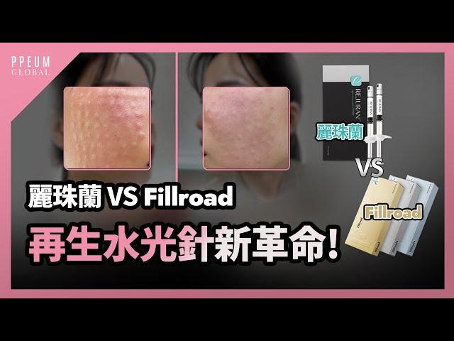 韓國醫美｜再生水光針新革命! 麗珠蘭水光針 VS Fillroad再生水光 韓國藝人的水光肌秘密 !!