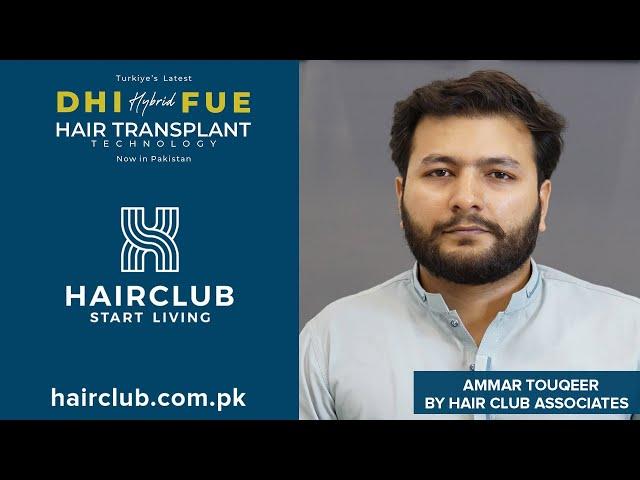 Hybrid FUE Hair Transplant with DHI Technology by Hair Club Associates.