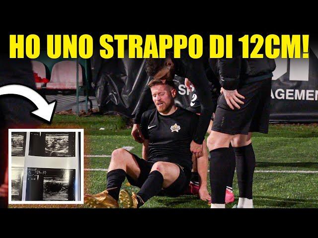 MI SONO FATTO UNO STRAPPO DI 12 CM ALLA GAMBA - INFORTUNIO GRAVE DI DUE MESI | ALL STAR GALACTICOS