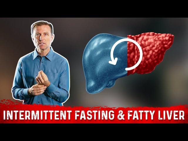 Can Intermittent Fasting Reverse a Fatty Liver? Fasting as Remedy for Fatty Liver – Dr. Berg