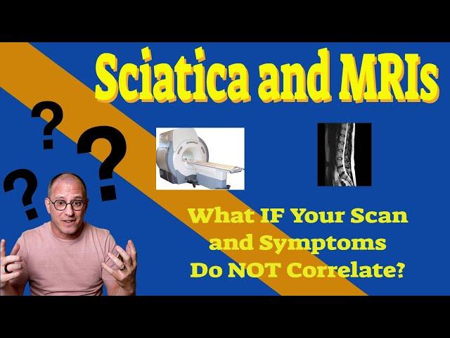 MRI For Sciatica?