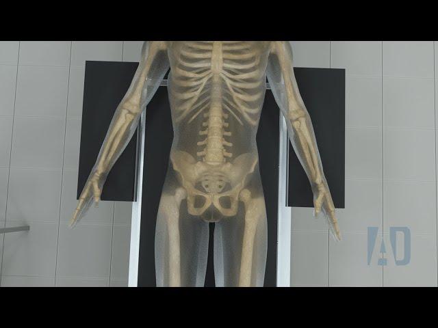 Orthopedic animations