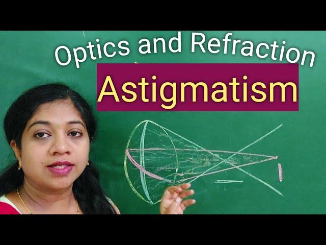 Astigmatism //Causes//Types //With the rule Astigmatism//Simple,compound,Mixed// Symptoms//Treatment