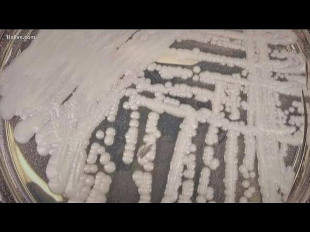 Deadly fungus spreads in hospitals | What you need to know