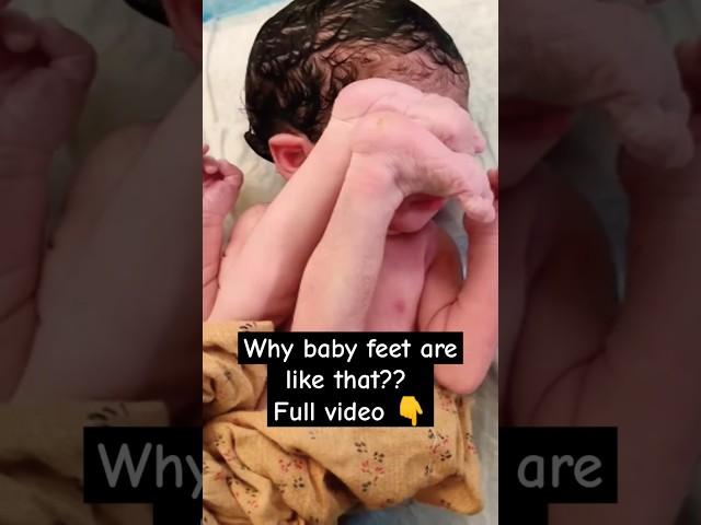 Why are baby feet like that?? #video #music #shorts #baby