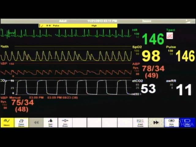 Cardiac Arrest - Patient Monitor