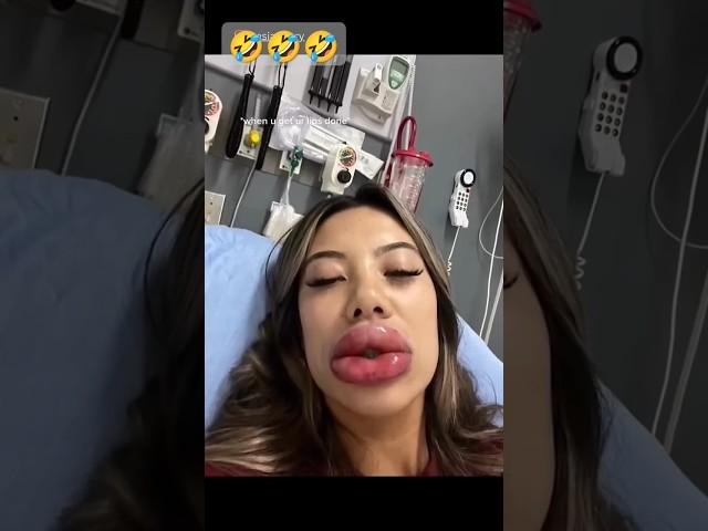 Wait for end #funny #comedy #shortsviral #comedymemes #surajroxfunnyvibeo