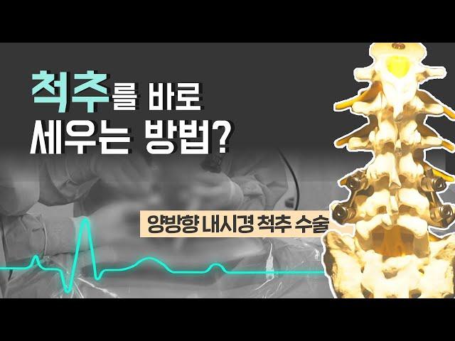 [닥터스] 척추를 바로 세우 양방형 내시경 척추 수술! (박원욱병원/051-1544-7582)