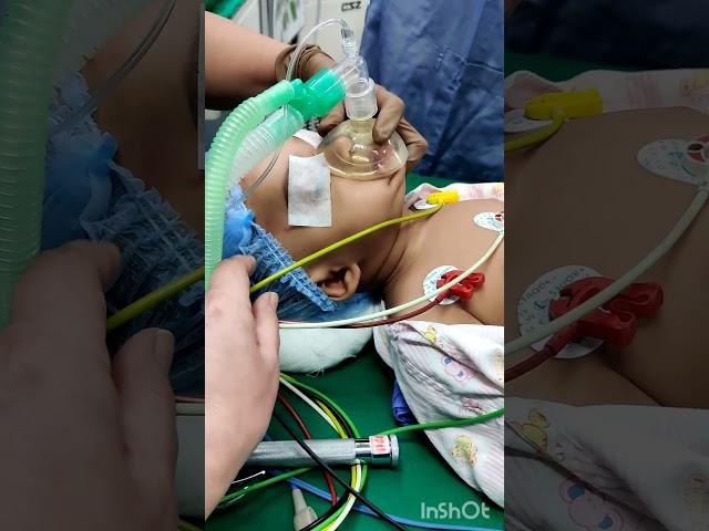 Pediatric Intubation