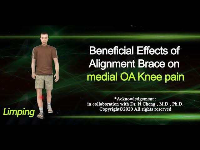 OA Knee Brace : Beneficial Effects of Alignment Brace on medial OA knee pain | K40a |(3d animation)