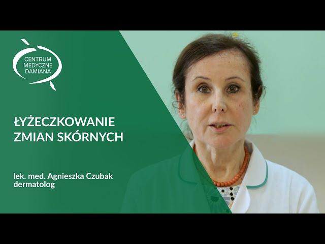 Łyżeczkowanie zmian skórnych - lek. med. Agnieszka Czubak, dermatolog