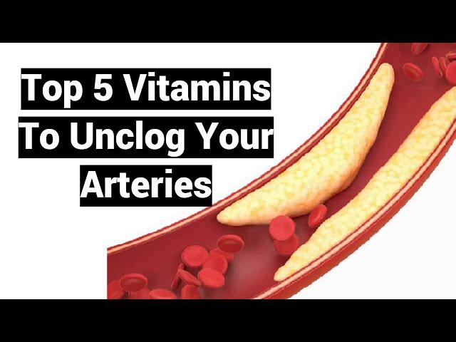 Top 5 Vitamins To Unclog Your Arteries