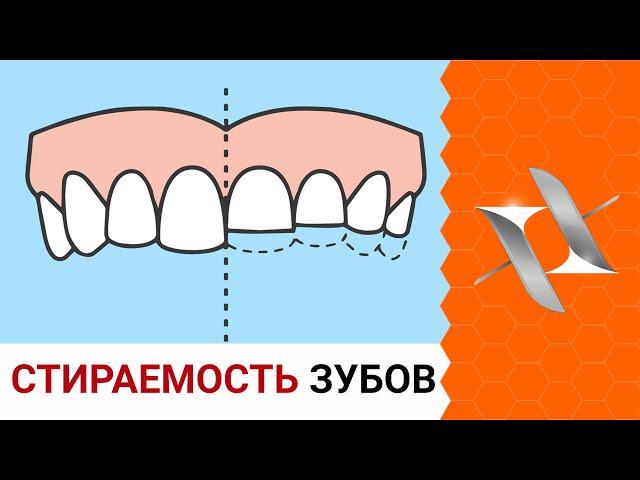 WASTE OF TEETH | The reasons. Effects. Treatment.