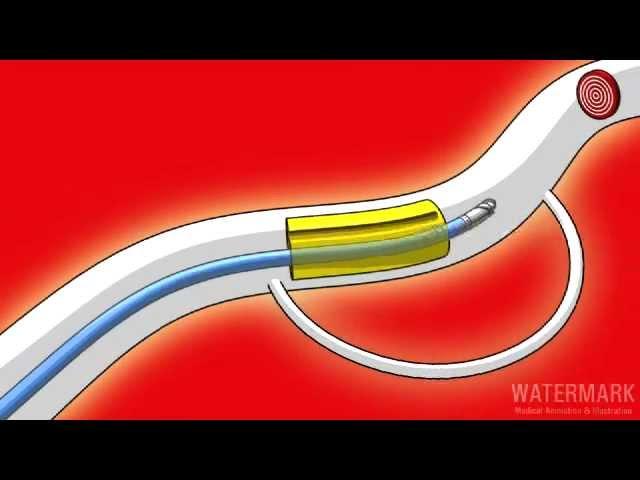 Watermark medical animation demo 3