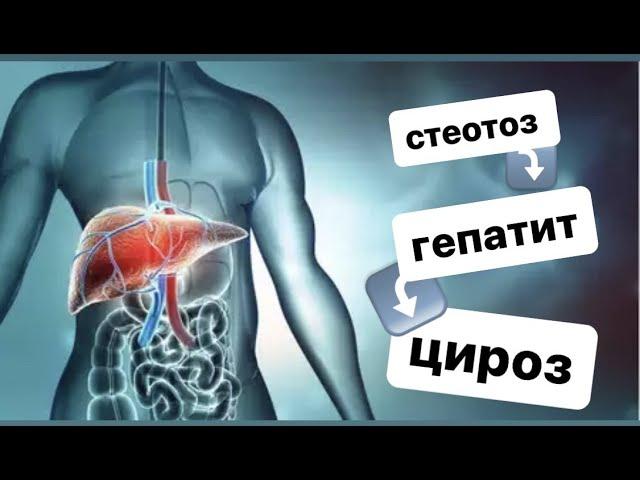 Три СТАДІЇ РУЙНУВАННЯ ПЕЧІНКИ через алкоголь