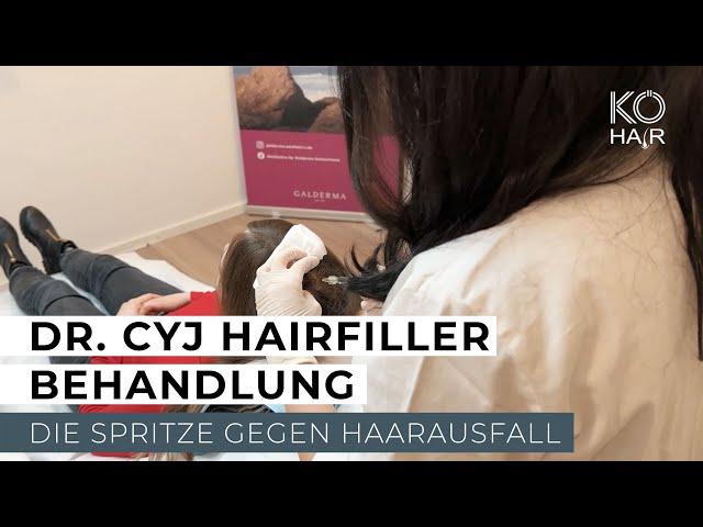 Innovativer Dr. Cyj Hairfiller gegen Haarausfall - KÖ-HAIR Klinik Düsseldorf