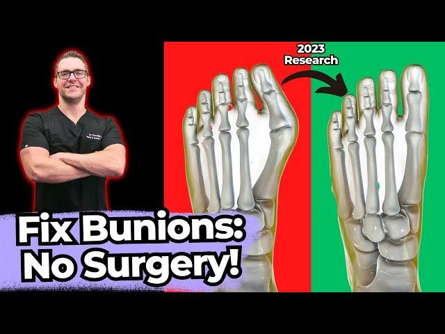 TOP 13 Ways to Shrink Bunions Naturally [+1 HUGE SECRET!]