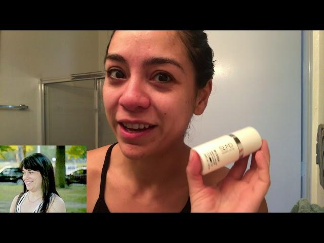 SLMD Skincare Acne system Review