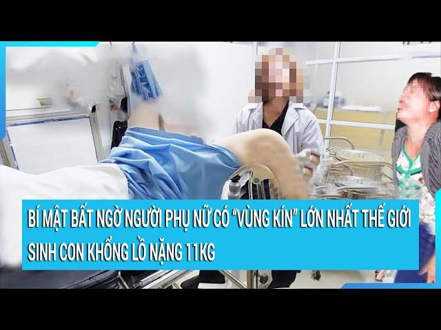 Bí mật bất ngờ người phụ nữ có “vùng kín” lớn nhất thế giới, sinh con khổng lồ nặng 11kg