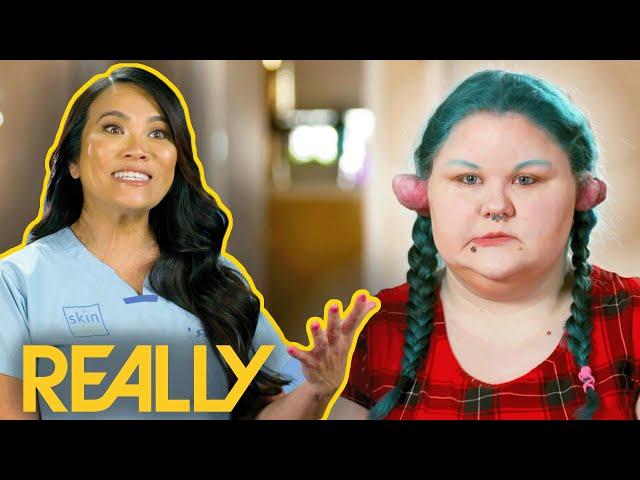 Dr Lee Removes Large Keloids From Cosplayer's Ears | Dr Pimple Popper: Pop Ups