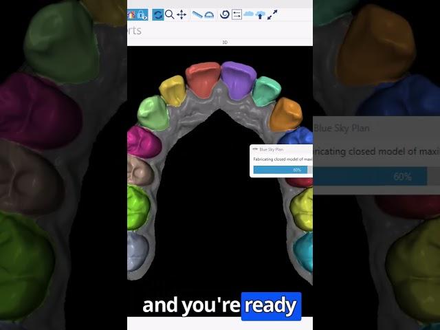 From Scan to Setup in Minutes: Automatic Aligner Data Preparation With a Single Click! #aligners