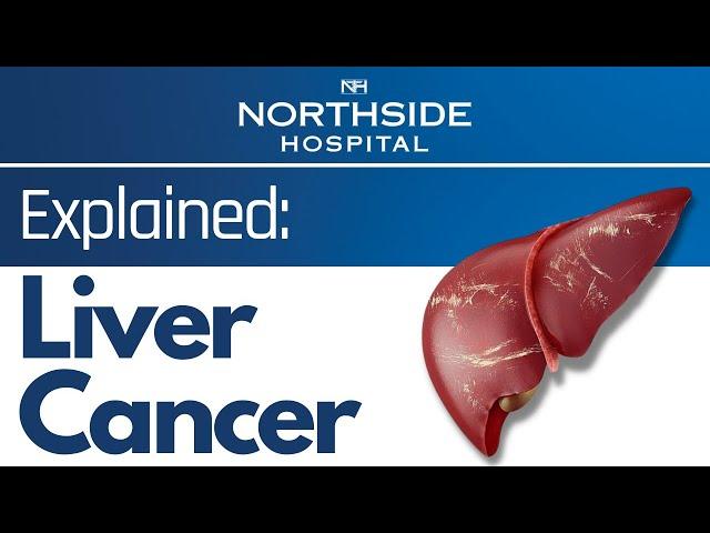 Liver Cancer Explained- Symptoms & Prevention of Liver Cancer