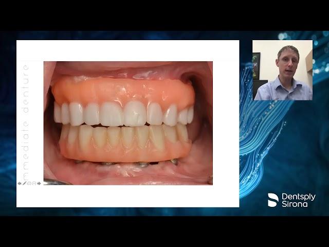 Full-Arch Digital Implant Restorations with Primescan and Atlantis BridgeBase