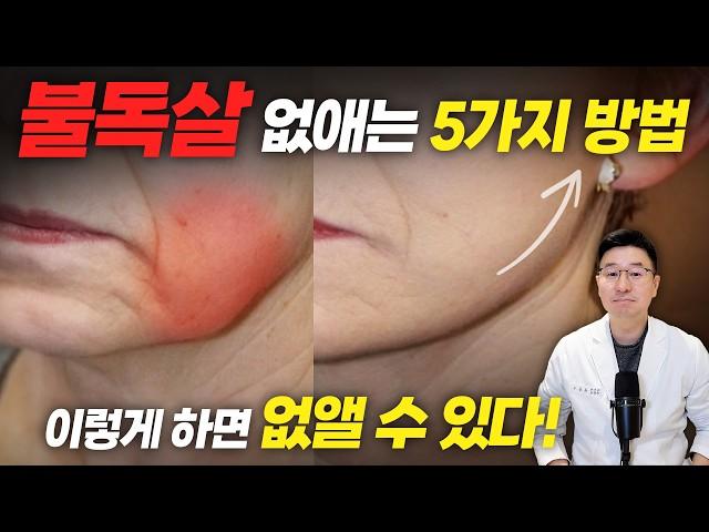 Afraid of Surgery for Sagging Jowls or Marionette Lines? Watch This Now!