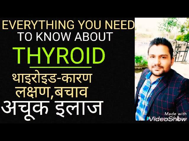 BEST TREATMENT OF THYROID PROBLEMS|MUST WATCH|थायरॉइड की समस्या का अचूक इलाज|DR.PRASHANT SHUKLA|