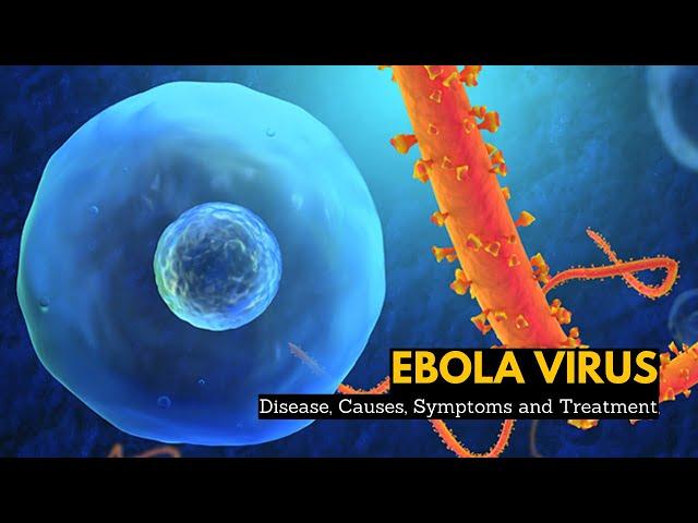 Ebola Virus Disease, Causes, Signs and Symptoms, Diagnosis and Treatment.