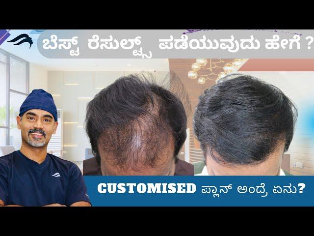 Hair Transplant In Bangalore | Best Clinic Results& surgeon Of Hair Transplant In Bangalore