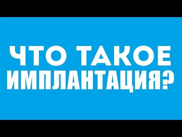 Что такое импланты? Плюсы имплантации