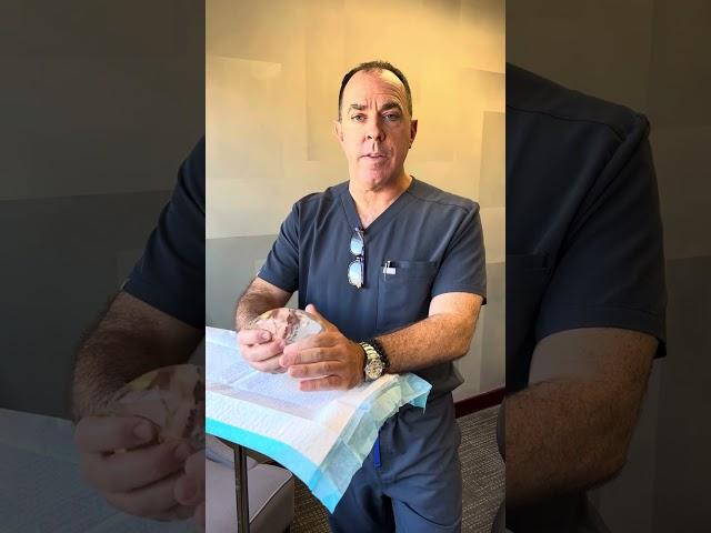 Board Certified Plastic Surgeon Sean Doherty reviews maintenance for breast implants