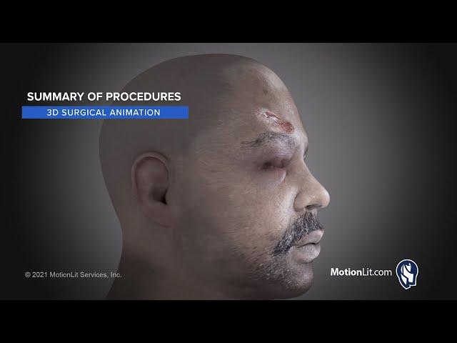 Surgical Animation Presents Summary of Injuries And Complex Procedures