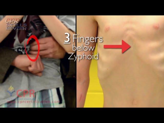 Choking Child | CPR Certification Institute