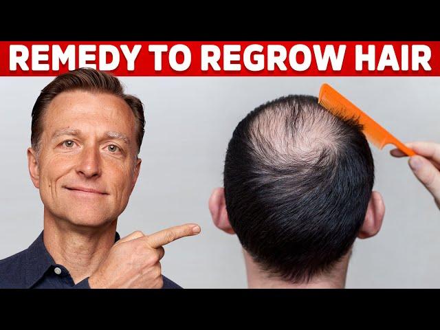 How to Regrow Hair (the Two Causes of Hair Loss) – Dr. Berg