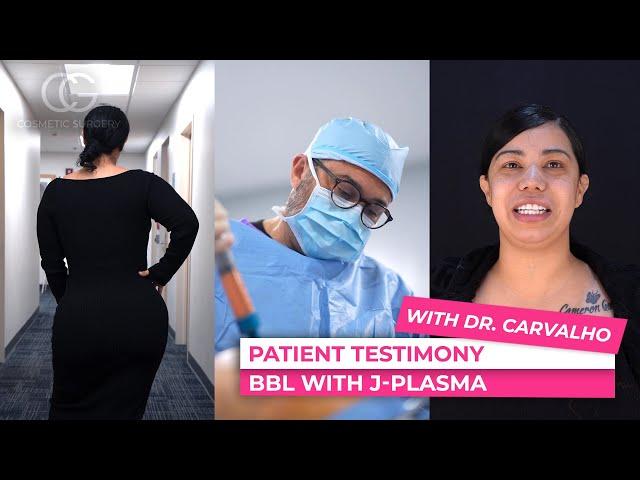 New Testimony: BBL with Dr. Carvalho   \ CG Cosmetic Surgery