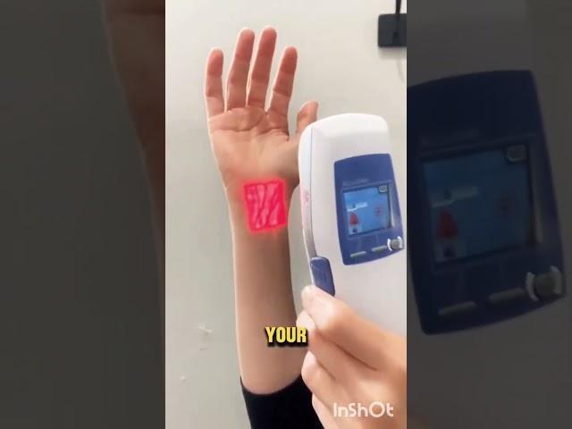 Veins glowing in Infrared light? #technology #laser #innovation #tech