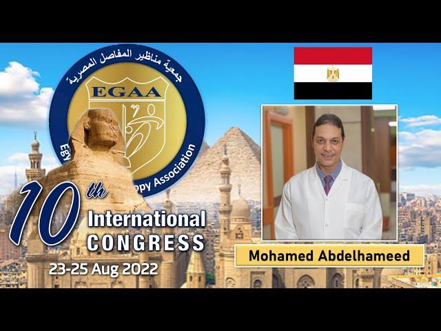 Cartilage regeneration by using 3D bioprinted adipose tissue Mohamed Abdelhameed