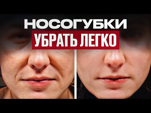 3 БЕЗОПАСНЫХ способа убрать носогубку  / Как ИЗБАВИТЬСЯ от носогубных складок навсегда?