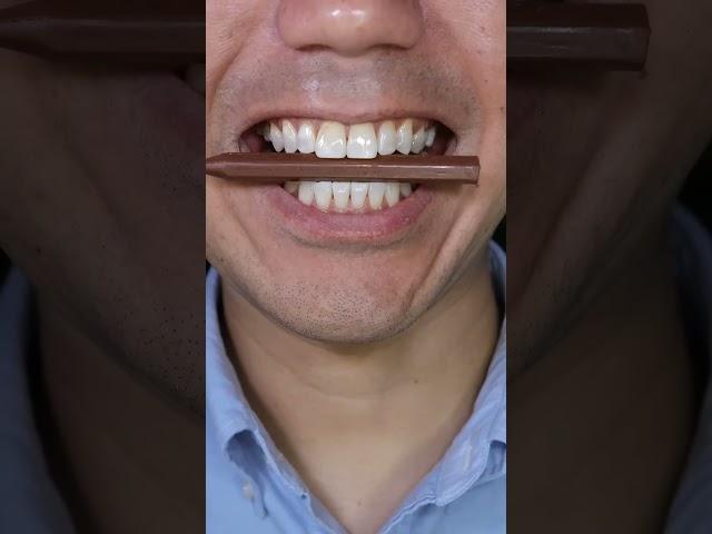Nobel Super Soda Candy ASMR//#funny #comedy #fun #toton #subscribe #shorts