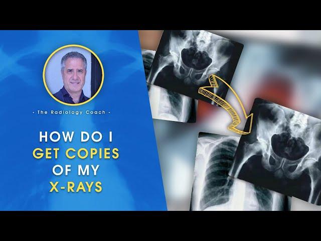 HOW do I GET COPIES of MY X-RAYS???