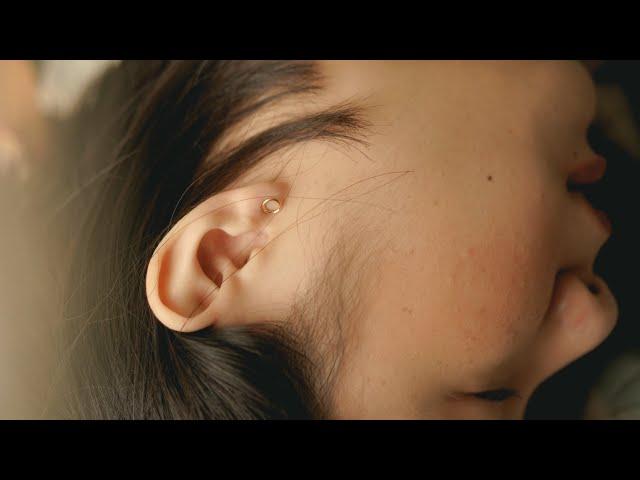 What is a perforated eardrum? | Patient Explainers